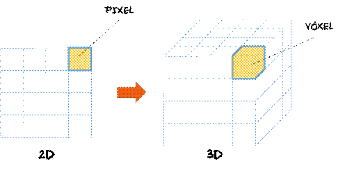 voxel